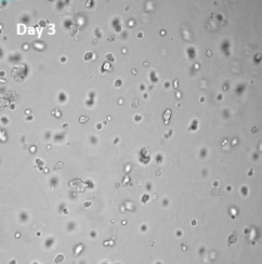 VitroGel COLを用いた膠芽腫細胞（SNB-75）の三次元培養2